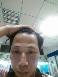  伏羲骨在女性面相中的象征意义